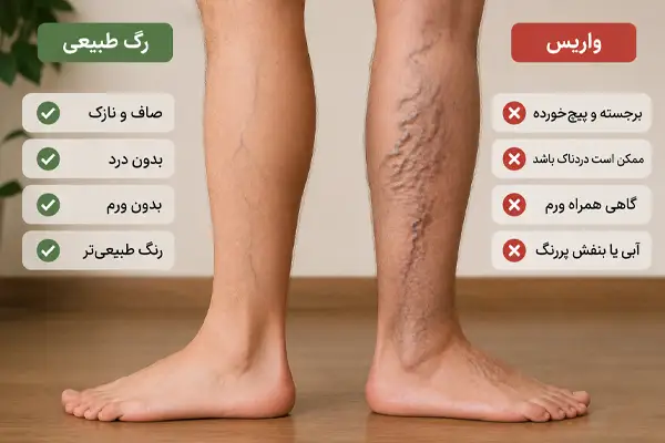 تفاوت واریس و رگ طبیعی چیست؟