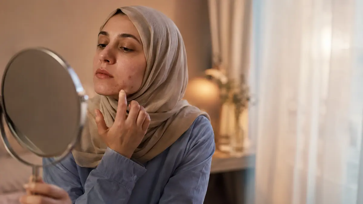 جوش زیرپوستی چیست و چه زمانی باید بررسی شود؟