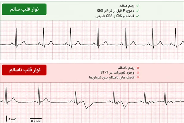 عکس نوار قلب سالم و ناسالم